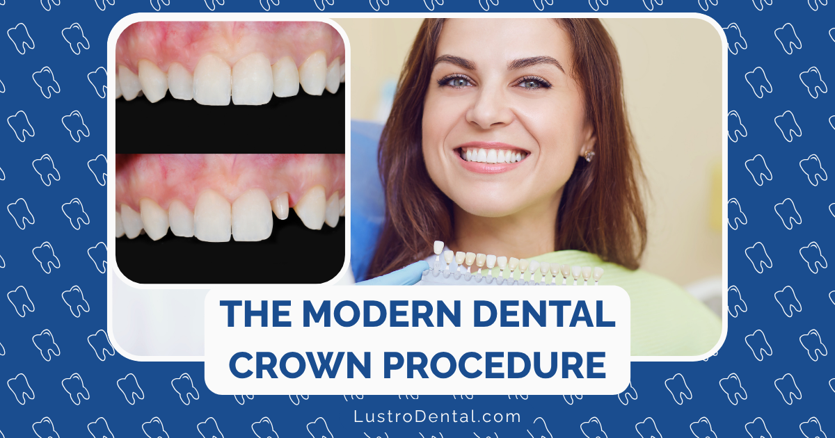 Crown Procedure Prep