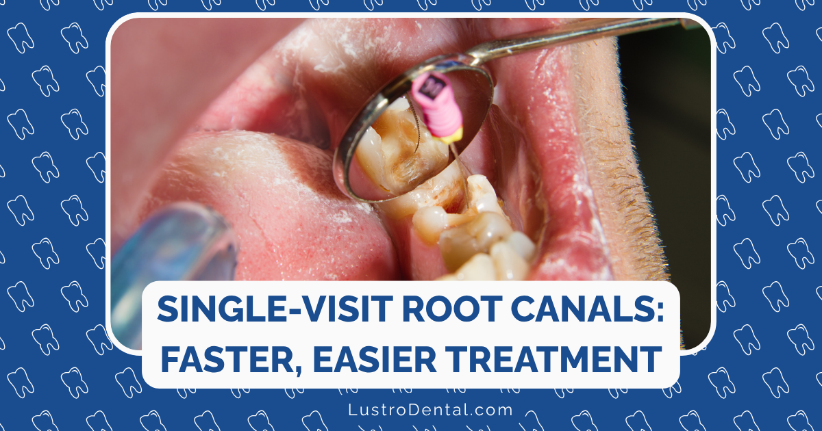 Single-Visit Root Canals