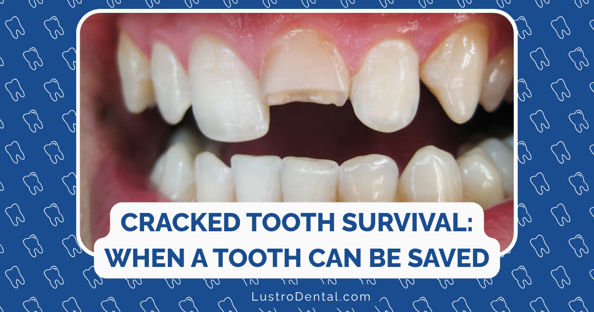 cracked tooth survival