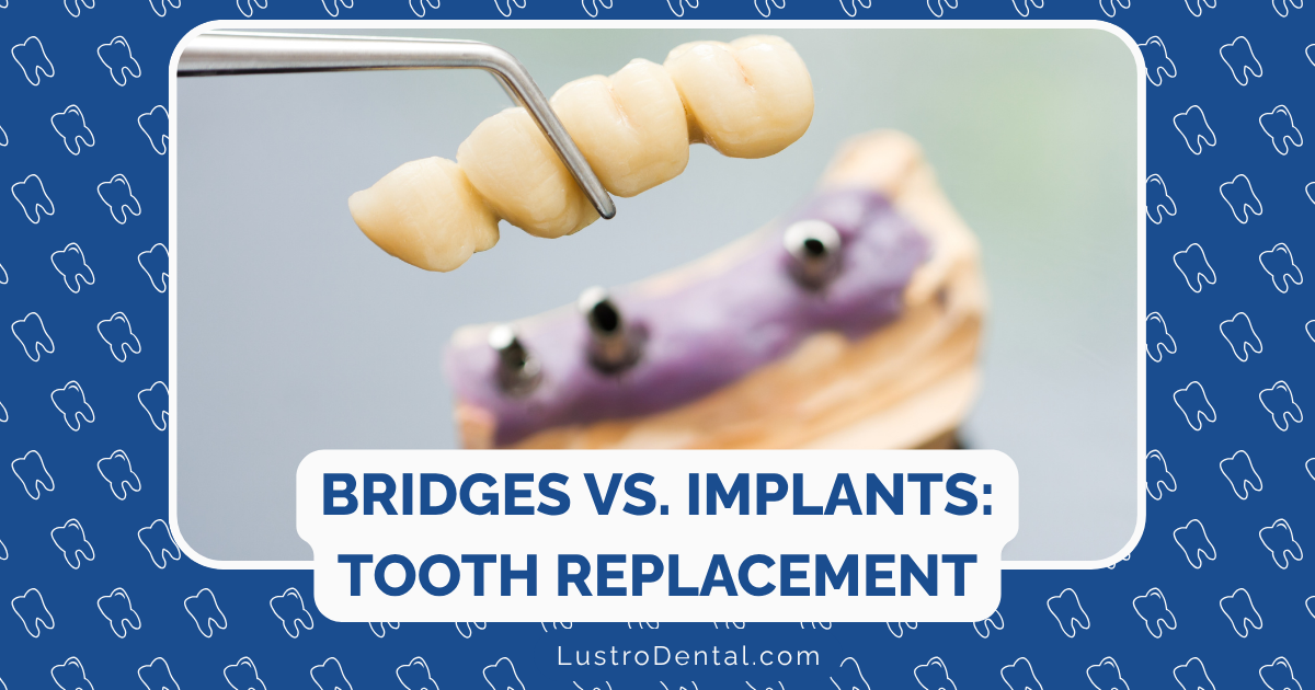 dental bridges and implants
