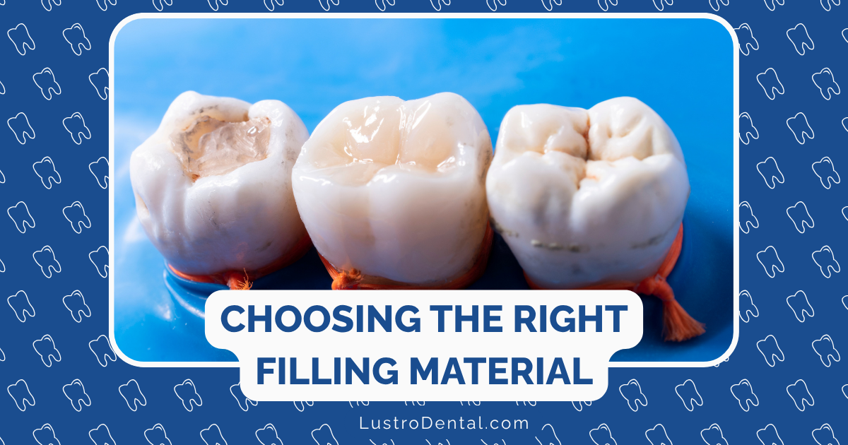 filling materials