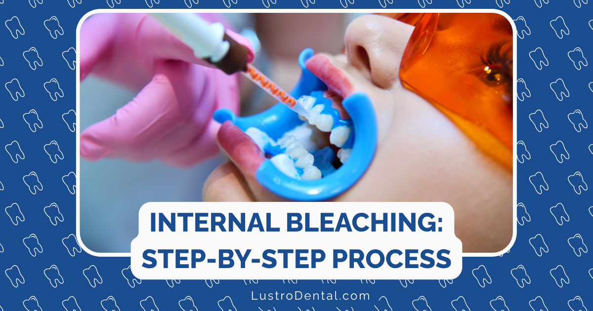 internal bleaching process