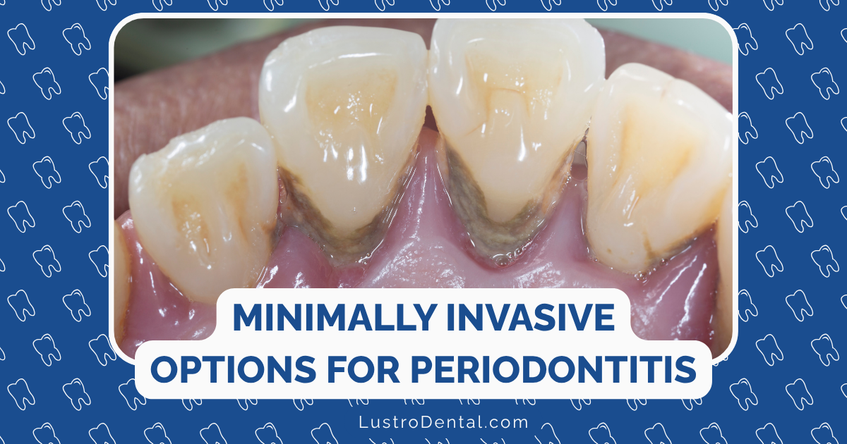 periodontitis treatments