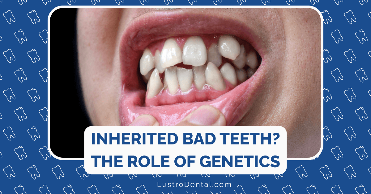 bad teeth and dental genetics