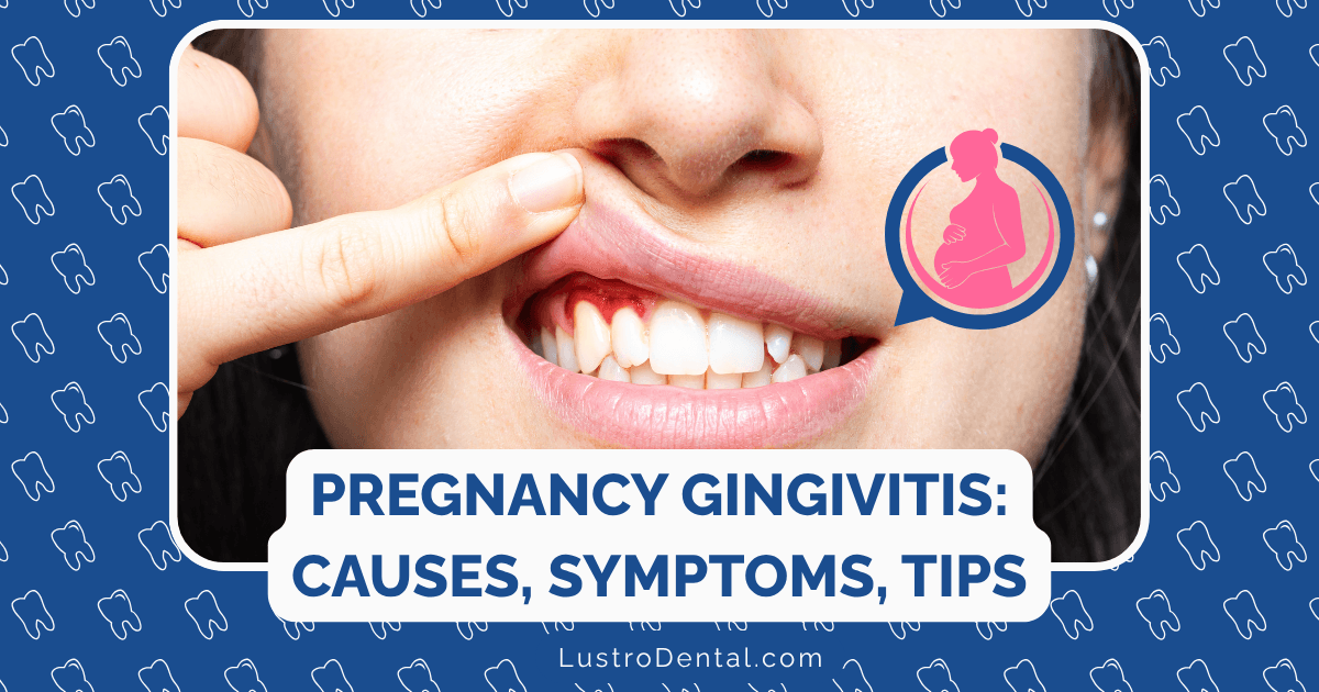 causes of pregnancy gingivitis