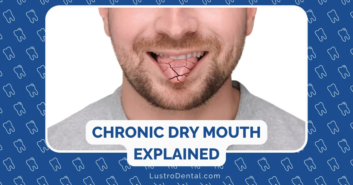 A man smiling with visibly dry, cracked lips and tongue—classic signs of chronic dry mouth, also known as xerostomia. Blue border with tooth icons, and text reads Chronic Dry Mouth Explained and LustroDental.com.