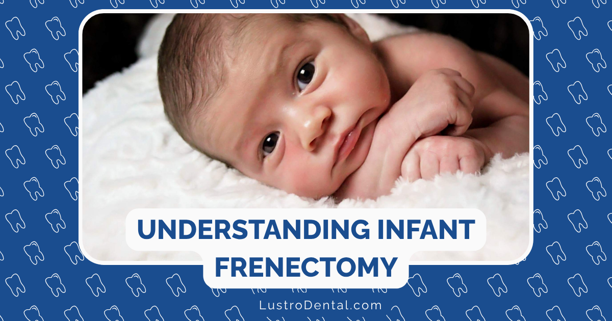 frenectomy for infants