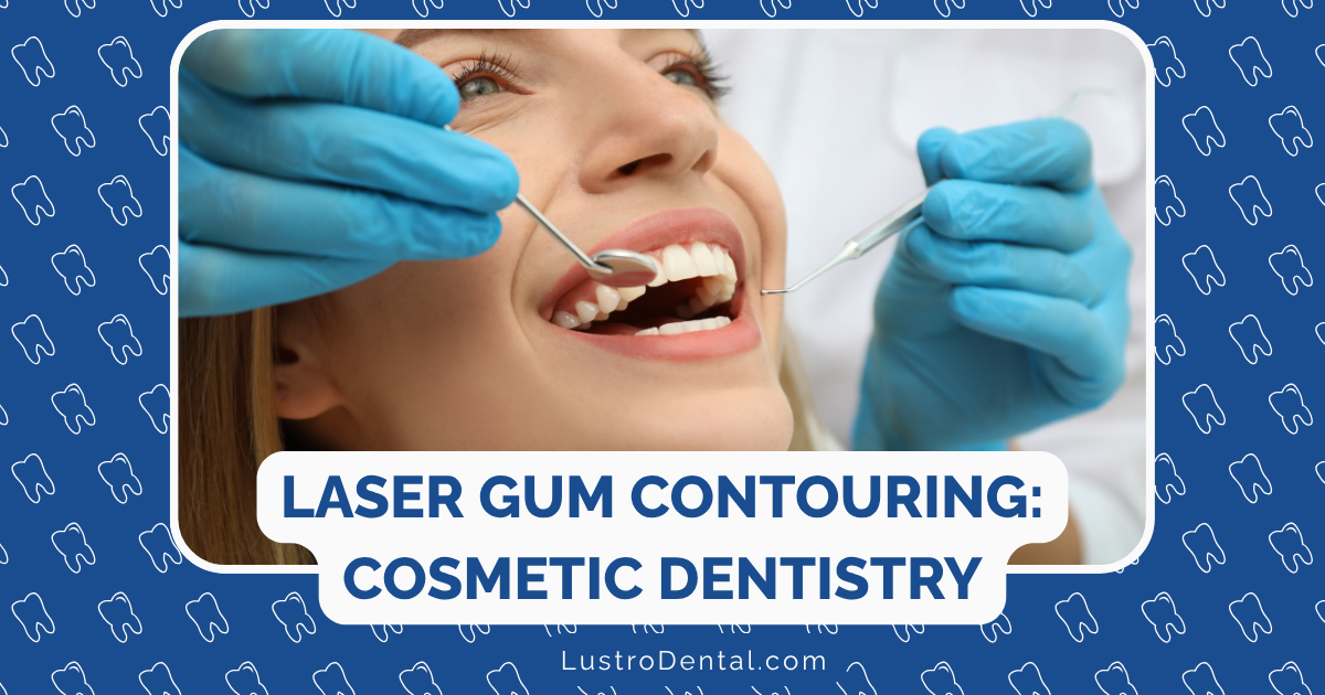 laser gum contouring