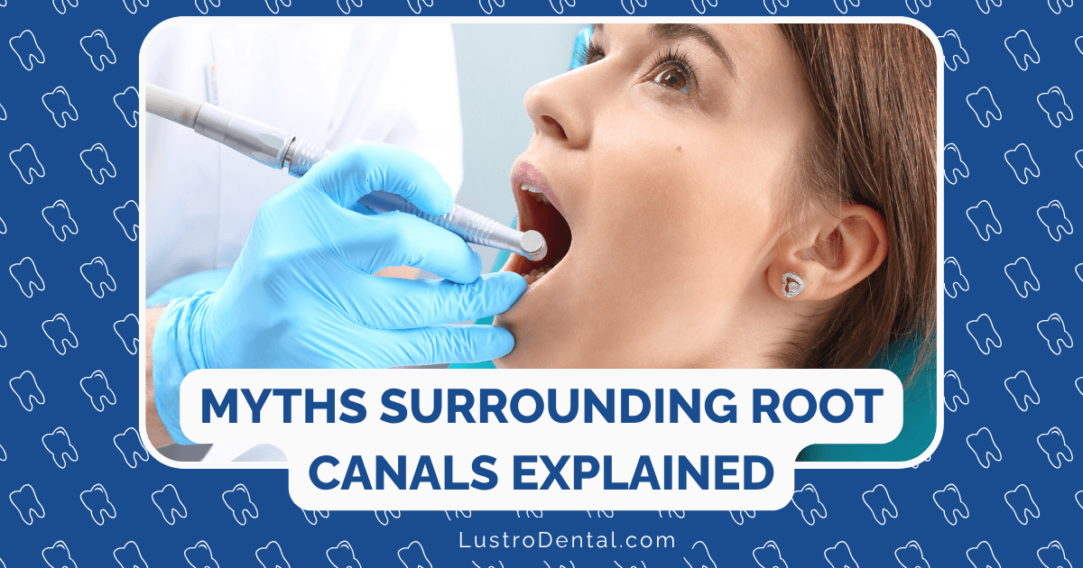 myths surrounding root canals