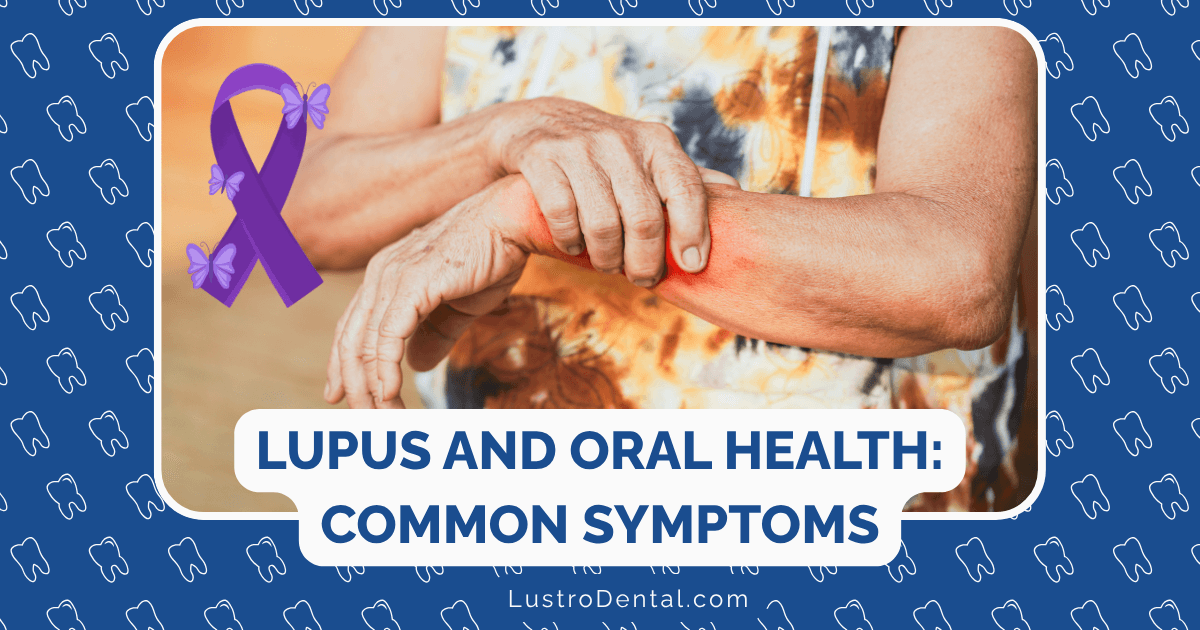 oral health in lupus patients