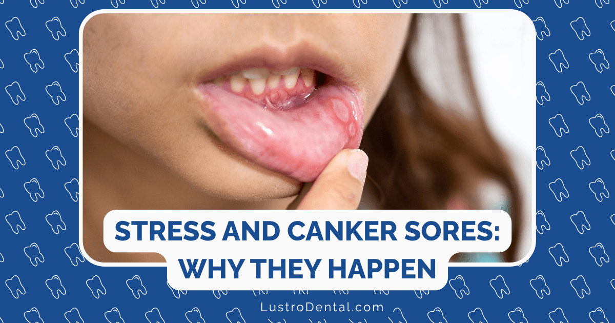 stress and canker sores