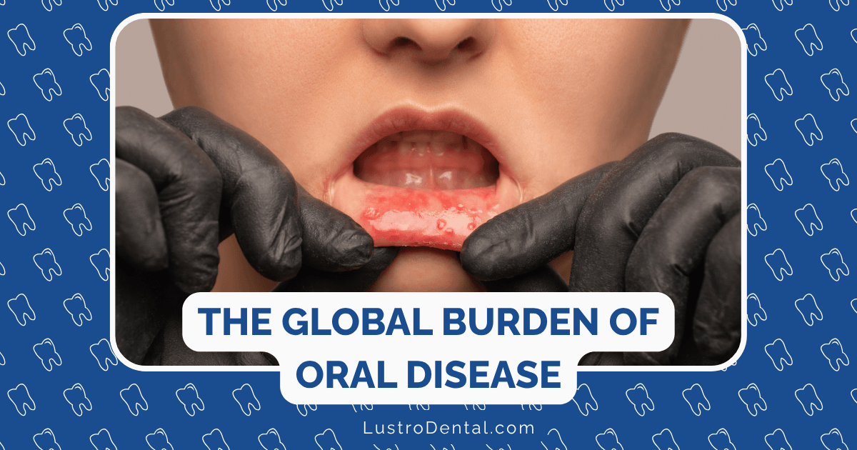 the global burden of oral disease